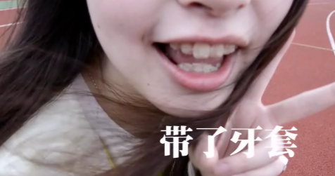 2015第十二屆學院獎等級獎作品-綜合類-菲樂綜合-銀獎-牙套妹的自白